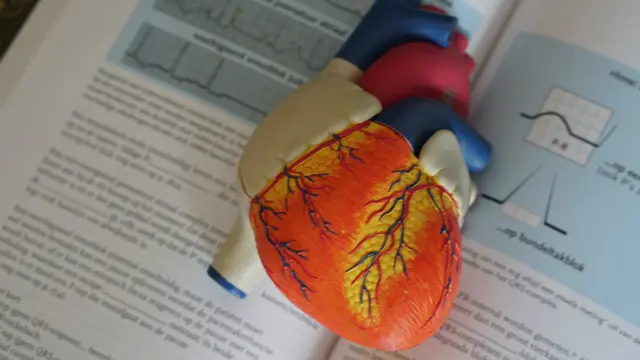 10 Cara Mengurangi Kolesterol, Panduan Lengkap untuk Hidup Sehat - Hot berita69.org