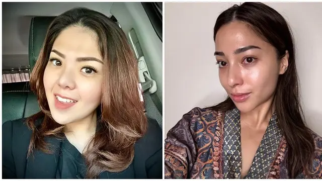 6 Mantan Artis Cilik Ini Pernah Dituding Oplas, Akui Hanya Perawatan Wajah - Hot berita69.org
