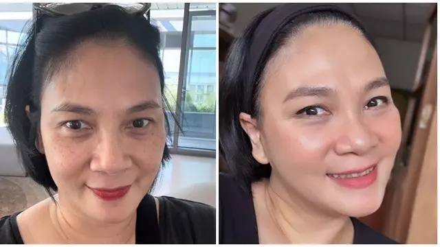 6 Potret Dian Nitami Pasca 3 Minggu Oplas Face Lifting, Kerutan Wajah Berkurang - Hot berita69.org